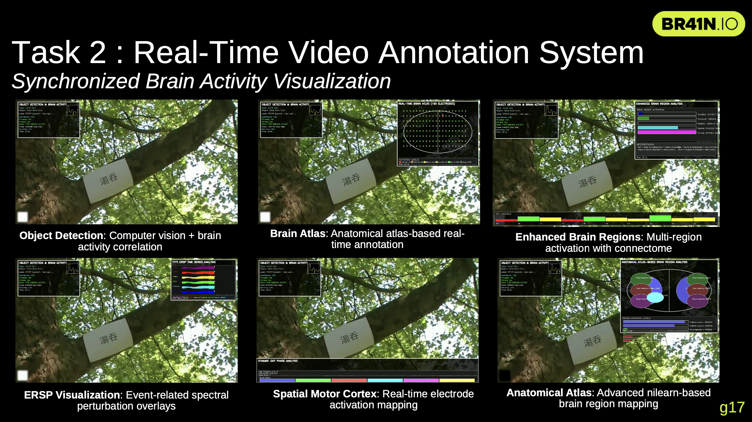 ECoG Video Analysis - Screenshot 2